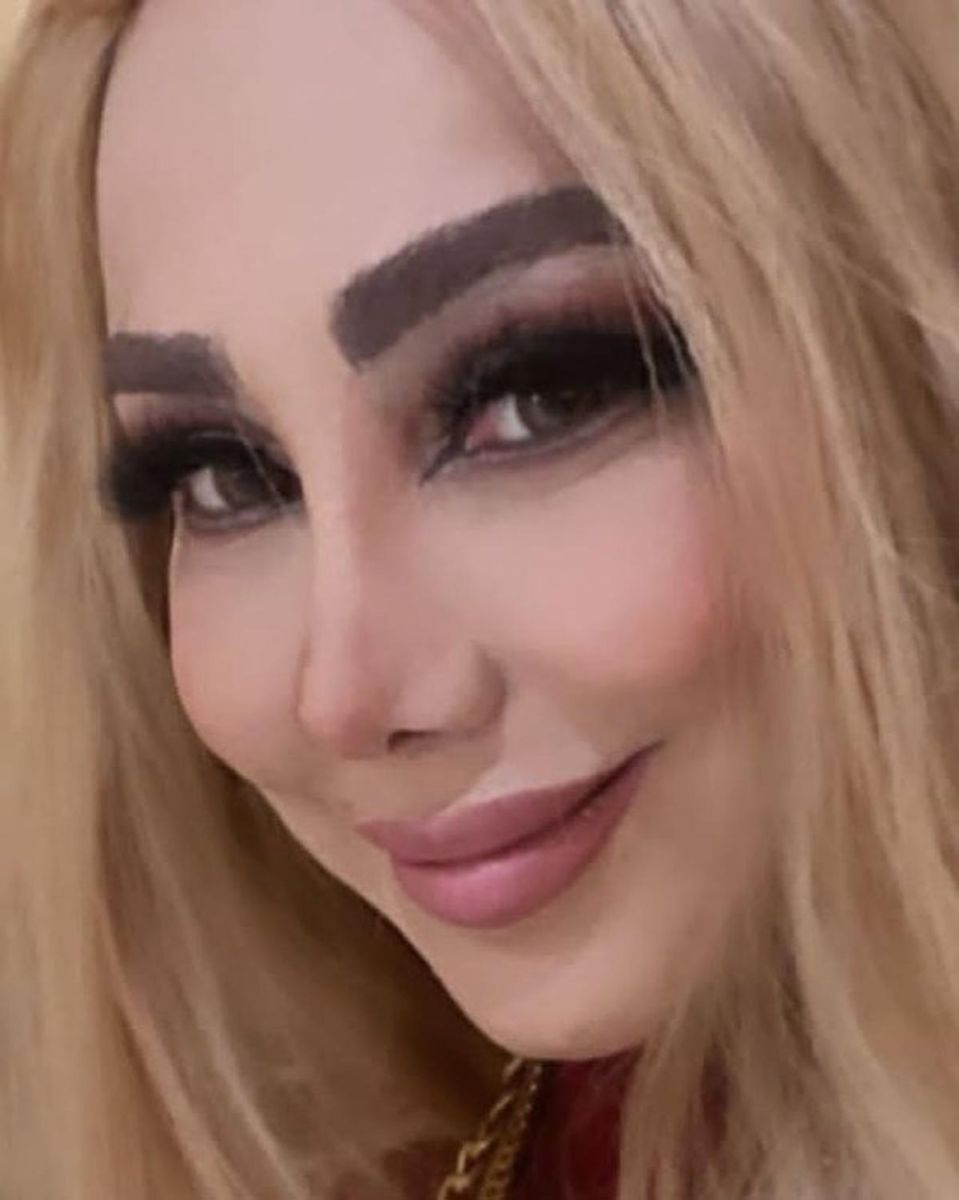 بهنوش بختیاری با عمل زیبایی دنیا جهانبخت شد + عکس بهنوش بختیاری با عمل زیبایی دنیا جهانبخت شد + عکس