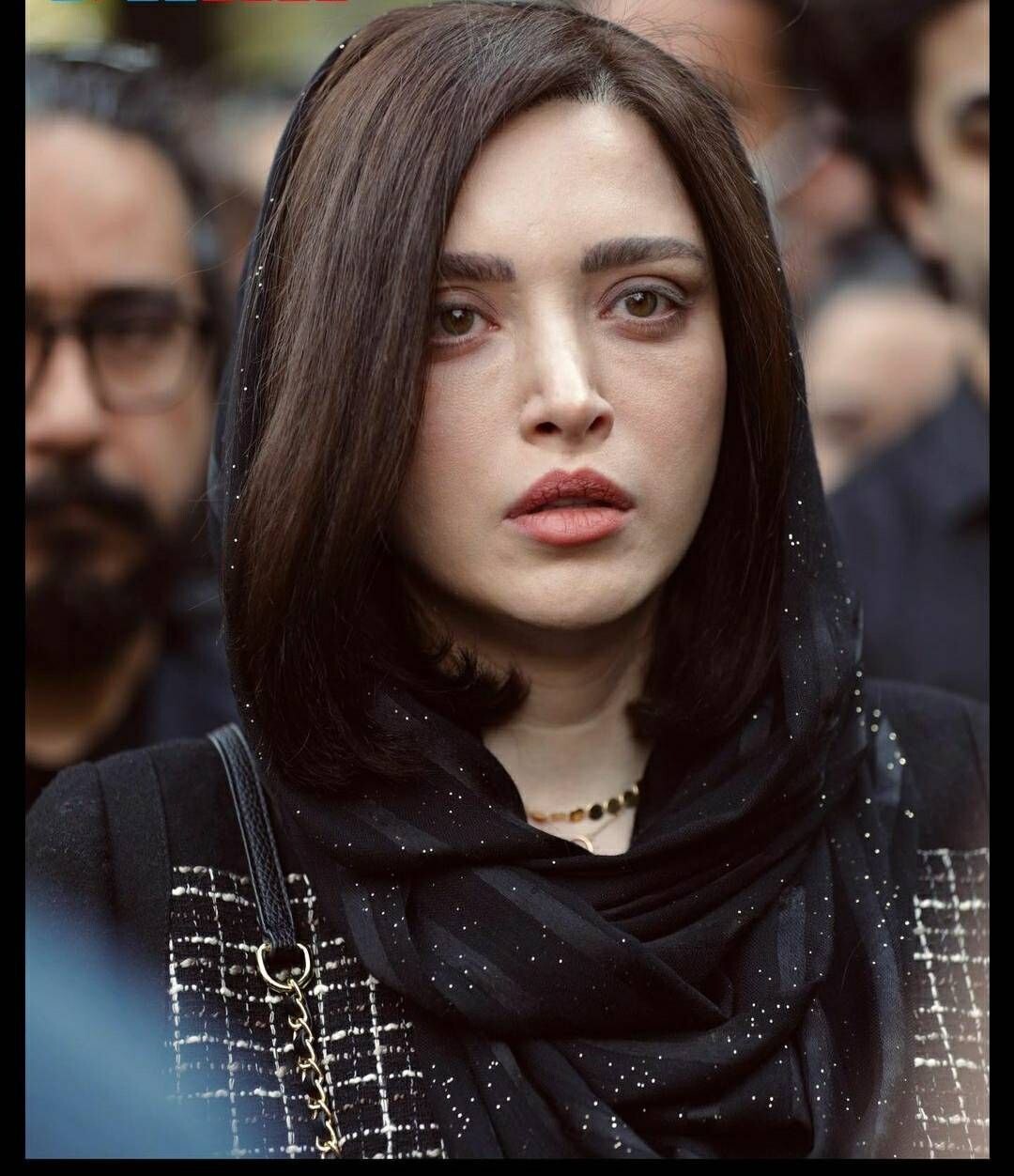 لو رفتن راز های عمل زیبایی بهنوش طباطبایی/عکس لو رفتن راز های عمل زیبایی بهنوش طباطبایی/عکس