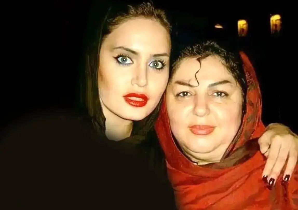 تفاوت عجیب چهره الناز شاکردوست با مادرش+ عکس تفاوت عجیب چهره الناز شاکردوست با مادرش+ عکس