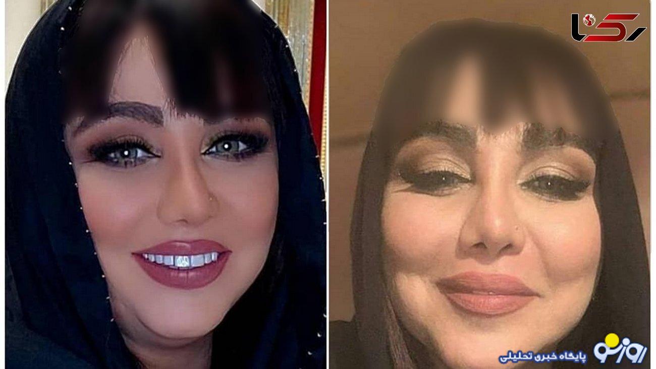 کتک کاری بهنوش بختیاری با همسرش / نمیخواهم طلاق بگیرم ! + فیلم کتک کاری بهنوش بختیاری با همسرش / نمیخواهم طلاق بگیرم ! + فیلم